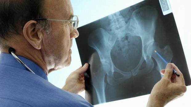 Osteopeniye Neden Olan Durumlar